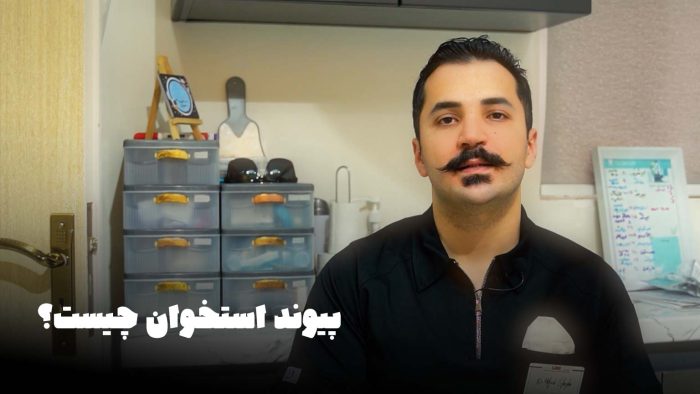 پیوند استخوان برای ایمپلنت