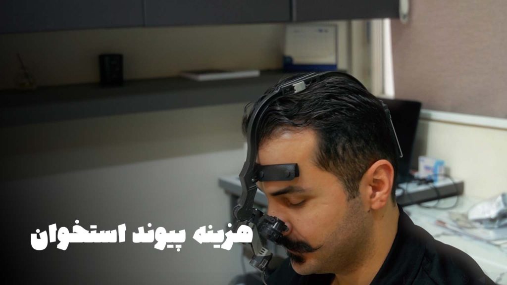 هزینه پیوند استخوان