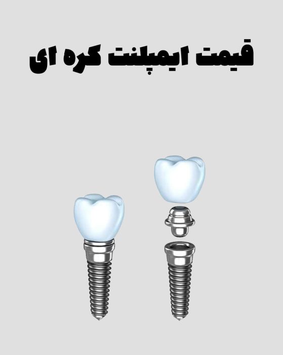 قیمت هر واحد ایمپلنت کره ای
