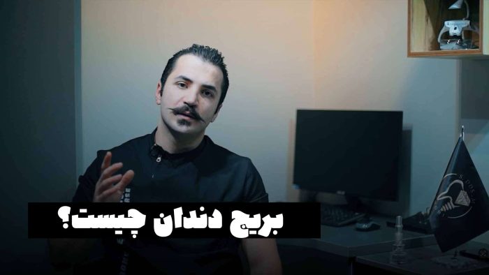 بریج دندان چیست